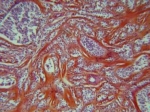 Skin zoom