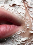 Dry skin