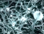 Neuronal